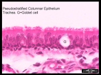 6-Pseudostratified Columnar Epithelium