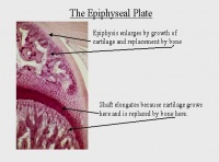 Epiphyseal plate