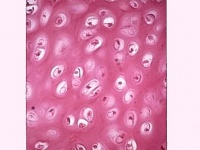 Hyaline cartilage