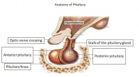 Pituitary pit
