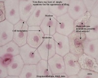 Simple squamous 400x PA021955md lbd